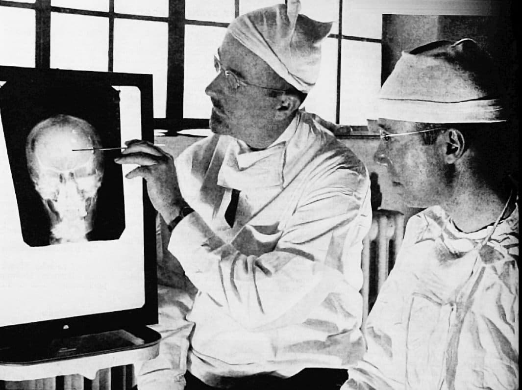 Dr's pointing at a lobotomy